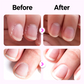 👍🧑‍⚕️ Reparación de daños en las uñas ✨ "Aroma + Manicura + Protección" en UN solo lápiz portátil para el cuidado de las uñas 💅